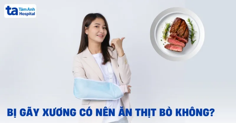 bị gãy xương có nên ăn thịt bò không