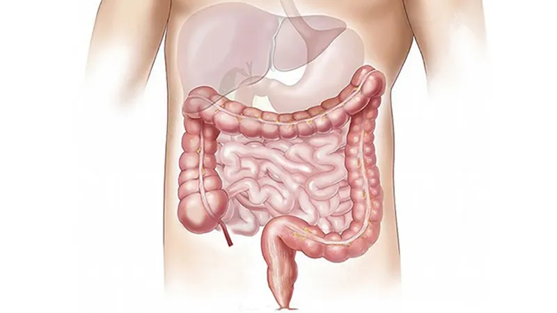 Dung dịch thụt tháo an toàn cho đại tràng